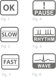 Figures caractéristique ECG