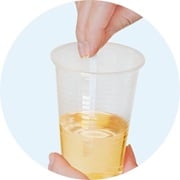Teststrip ondergedompeld in de urine sample