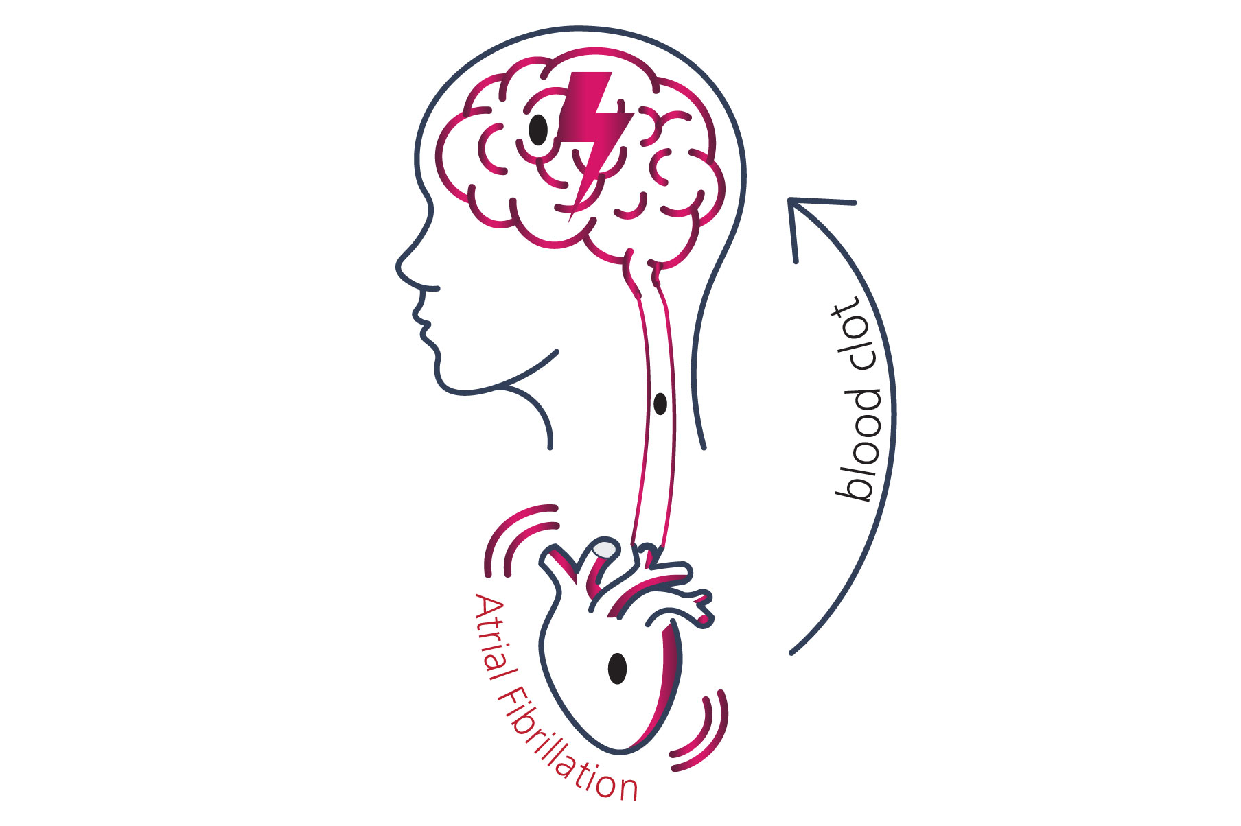 ECG-Product Features-Atrial