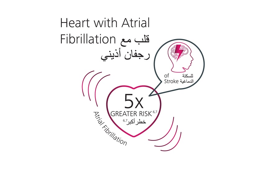 ECG-Product Features_Atrial Fibrillation